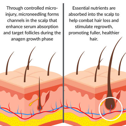 Alphafuse - Infusion Hair Regrowth Kit